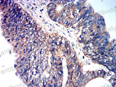 Валидация AntibodySystem RHJ88602 (3570)