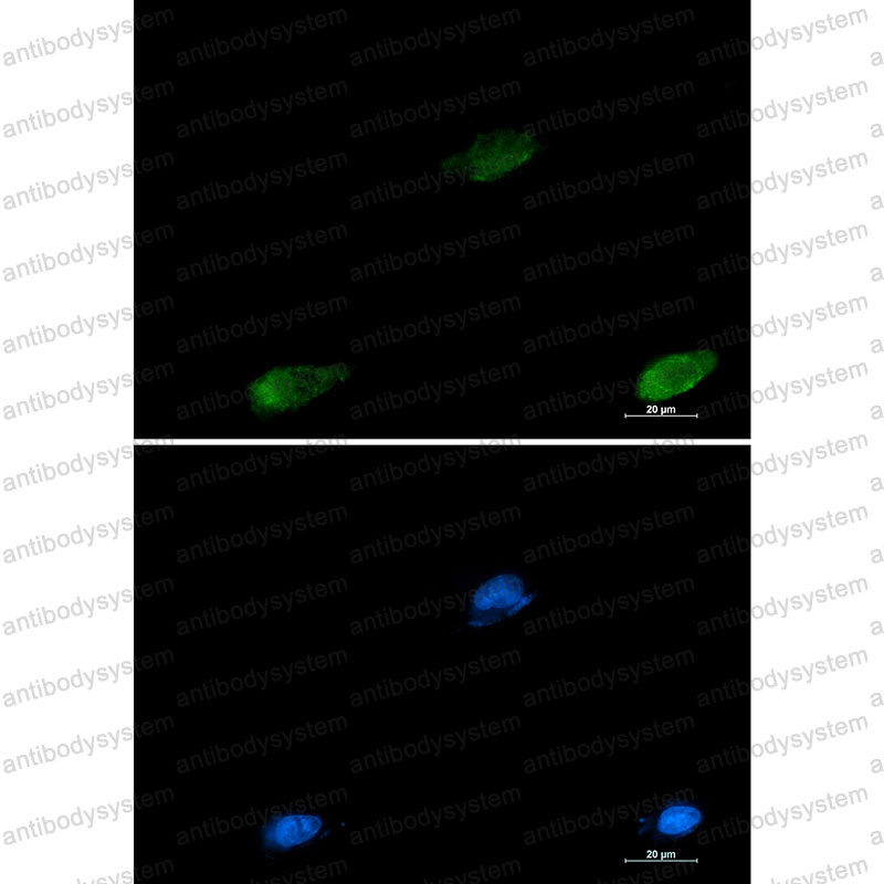 Валидация IF - AntibodySystem RHD27106