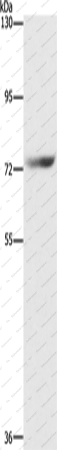 Вестерн-блоттинг, SENP1, клетки HepG2