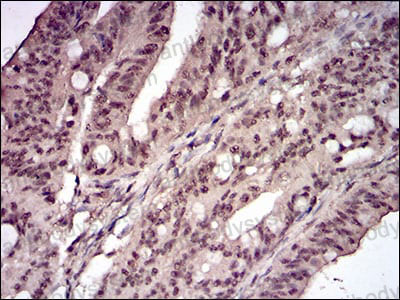 Валидация AntibodySystem RHD64402