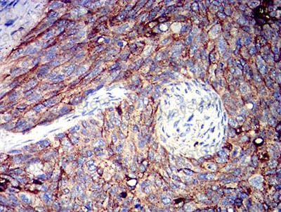 Валидация AntibodySystem RHG64007 (3040)