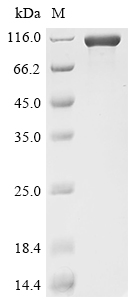 SDS-PAGE