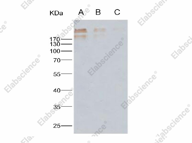 Вестерн-блоттинг, HCMV Glycoprotein B/gB, рекомбинантный белок