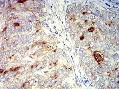 Валидация AntibodySystem RHD14205 (1351)