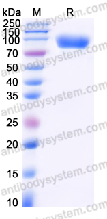 AHH45202, SDS-PAGE