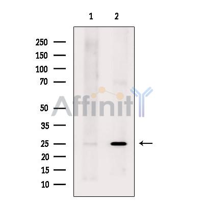 Валидация Affinity DF9160 - 21518