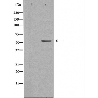 Валидация Affinity DF3468 - 14379