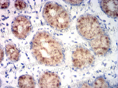 Валидация AntibodySystem RHF78604