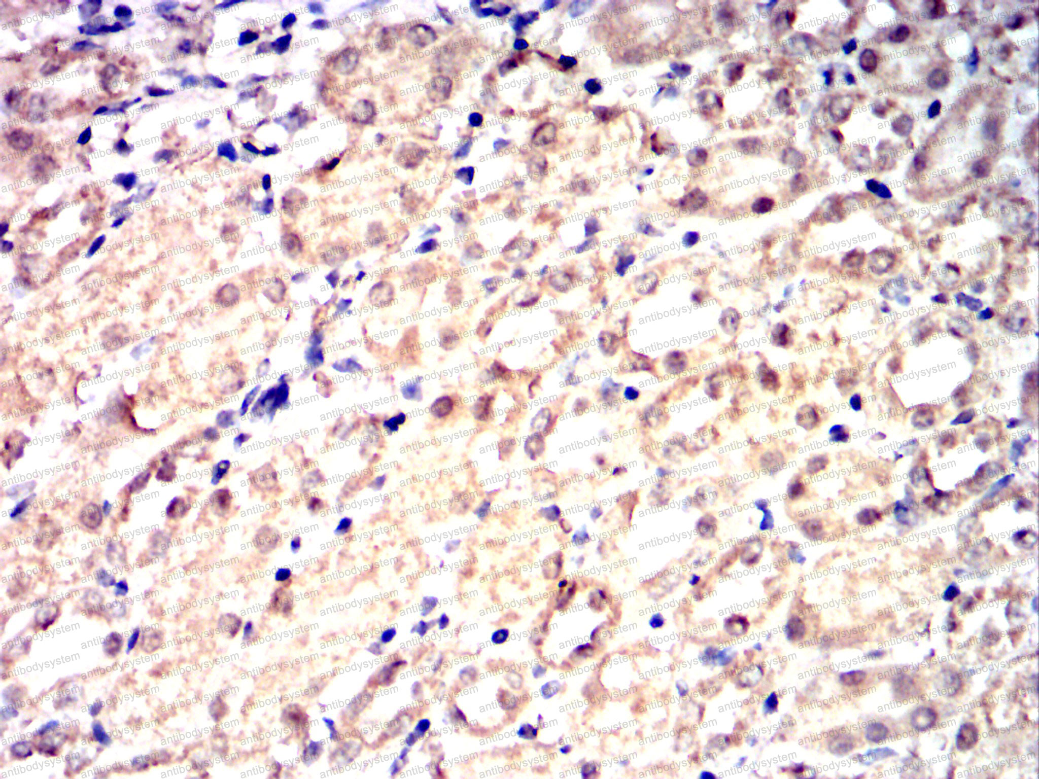 Валидация AntibodySystem RHK91801