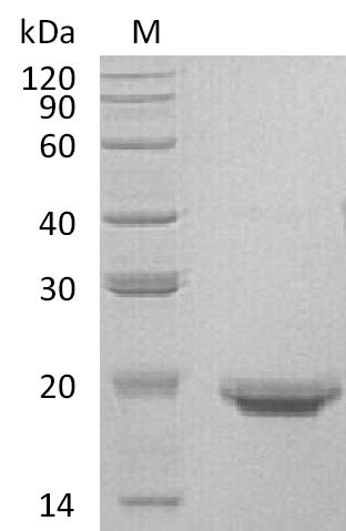 SDS-PAGE
