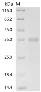 SDS-PAGE