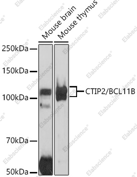 Вестерн-блоттинг, CTIP2/BCL11B, различные клеточные линии