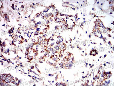 Валидация AntibodySystem RHF03904