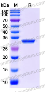 EHJ92903, SDS-PAGE