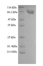 SDS-PAGE