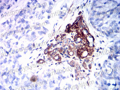 Валидация AntibodySystem RHF52707 (2548)