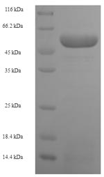 SDS-PAGE