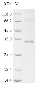 SDS-PAGE