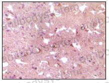 Валидация AntibodySystem RHC12517