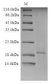 SDS-PAGE
