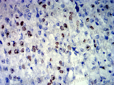 Валидация AntibodySystem RHE46101 (2179)