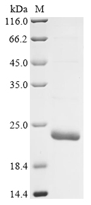 SDS-PAGE
