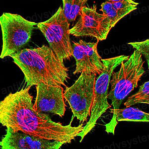 Валидация IF - AntibodySystem RHC22902