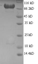 SDS-PAGE
