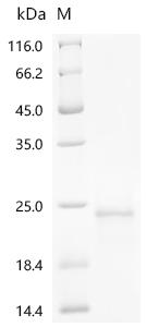 SDS-PAGE