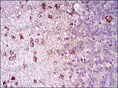 Валидация AntibodySystem RHD38503