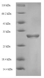SDS-PAGE