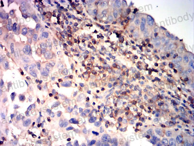 Валидация AntibodySystem RHF45102