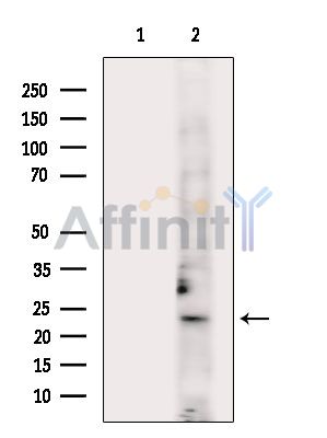Валидация Affinity DF6304 - 17620