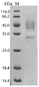 SDS-PAGE