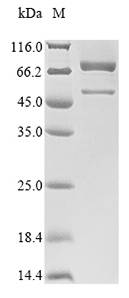SDS-PAGE