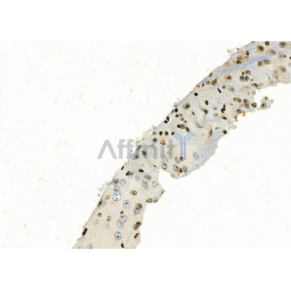 Валидация Affinity AF9149 - 4949