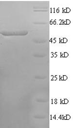SDS-PAGE
