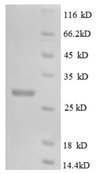 SDS-PAGE