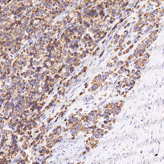 Валидация AntibodySystem RHD47804