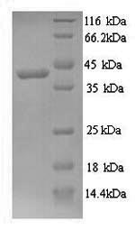 SDS-PAGE