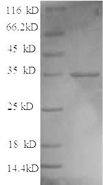 SDS-PAGE
