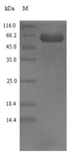 SDS-PAGE