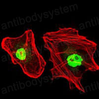 Валидация IF - AntibodySystem RHD74702