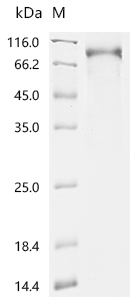 SDS-PAGE