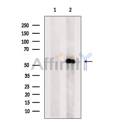 Валидация Affinity DF8962 - 21140