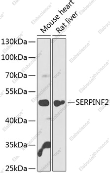 Вестерн-блоттинг, SERPINF2, различные клеточные линии