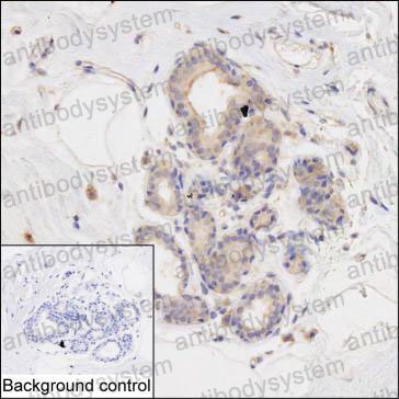 Валидация AntibodySystem RHC15503