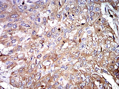 Валидация AntibodySystem RHJ92402