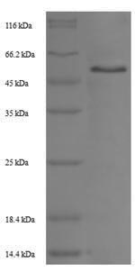 SDS-PAGE