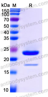 YHG40201, SDS-PAGE